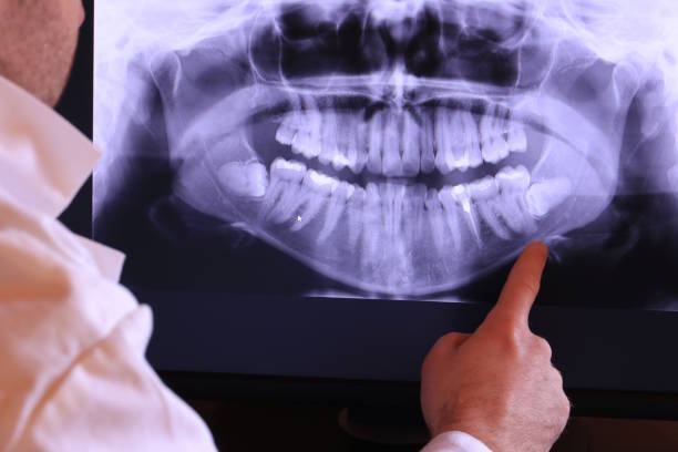 Best Mobile Emergency Dentist in Morocco, IN