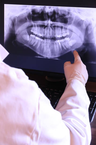 Best Emergency Dental Extractions in Morocco, IN