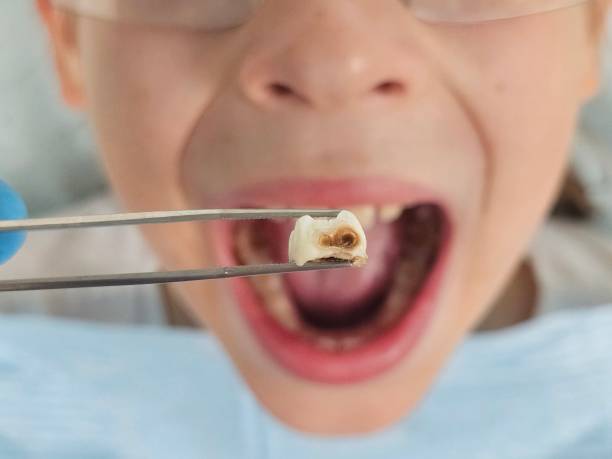 Best Mobile Emergency Dentist in Morocco, IN