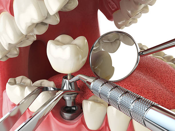 Best Holiday Emergency Dentist in Morocco, IN